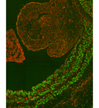 university uppsala mats nillson molekular diagnostik molecular diagnostic
